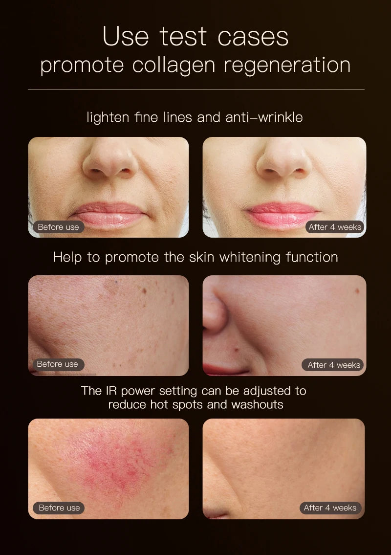 Infrared Red Blue Yellow 4 Colors Light Therapy Anti-Aging Photon Rejuvenation Soft Silicone LED Face Mask